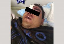 Sicario es atropellado tras matar a un hombre