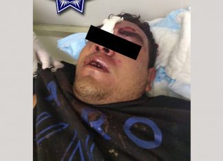 Sicario es atropellado tras matar a un hombre