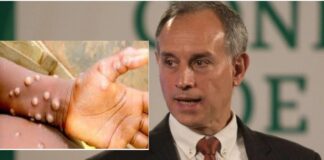 Confirman primer caso de viruela del mono en México