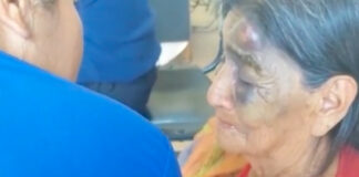Abuelita recibe golpiza de su esposo por ponerle mucha sal al arroz