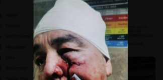 A cirugía mayor el maestro herido a martillazos por su alumno