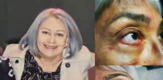 Arquitectos, abogados, enfermeras y amas de casa realizan cirugías plásticas en Chihuahua