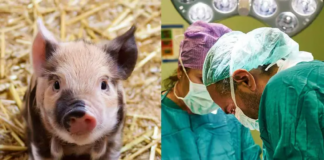 Hombre recibe riñón de un cerdo genéticamente modificado y ya produce orina